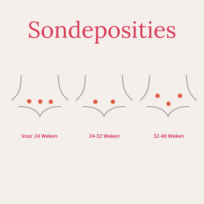 Sensitest Fetal Doppler Babyhartje Monitor – Inclusief Aquasonic Ultrasound Gel 60g